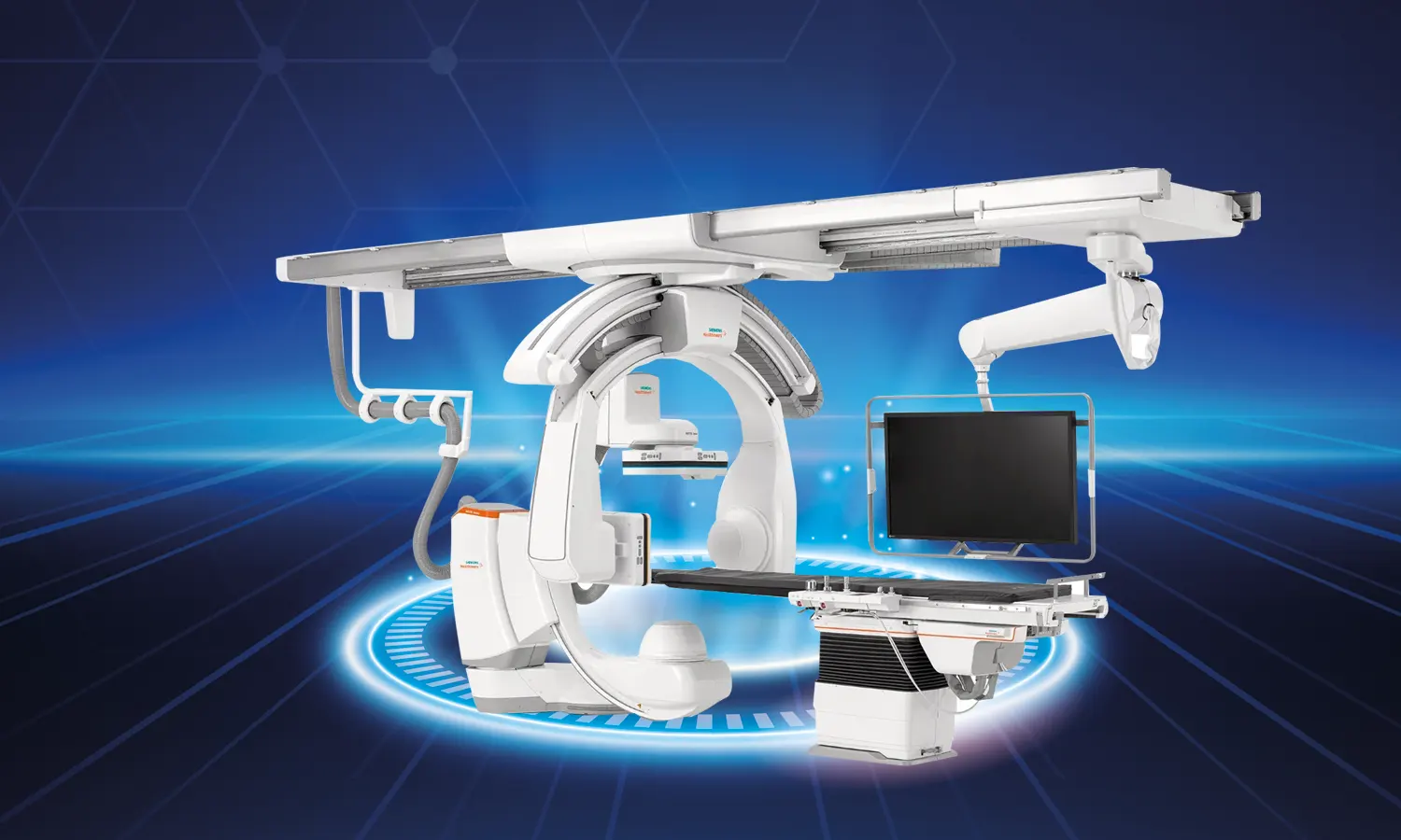 4-Dimensional Angiography