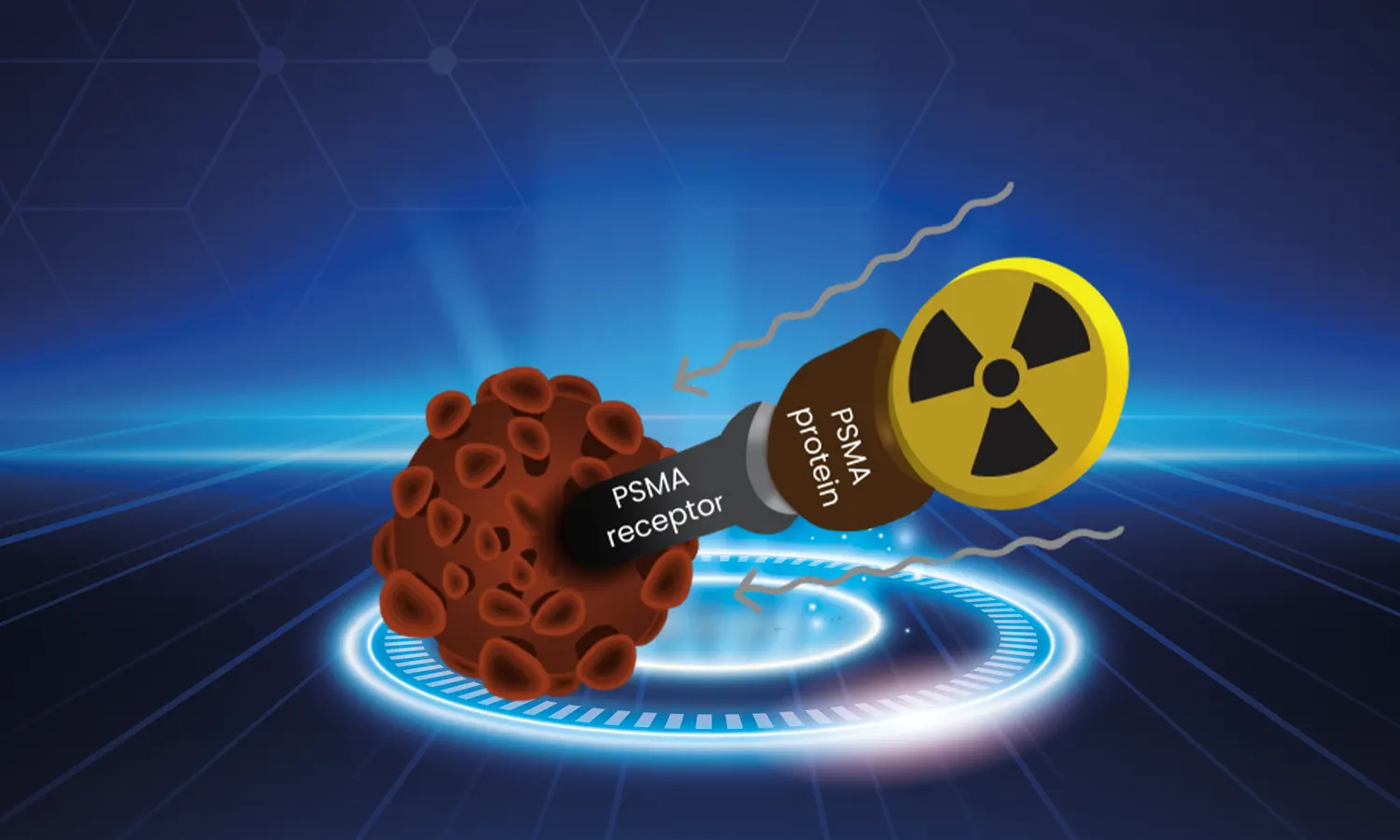 Lutetium 177 PSMA Treatment