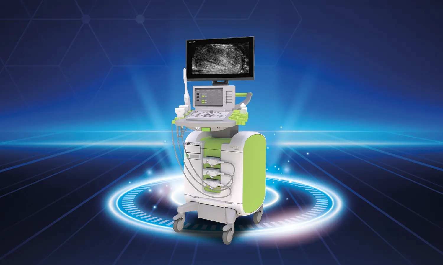 Micro Ultrasound Fusion Biopsy