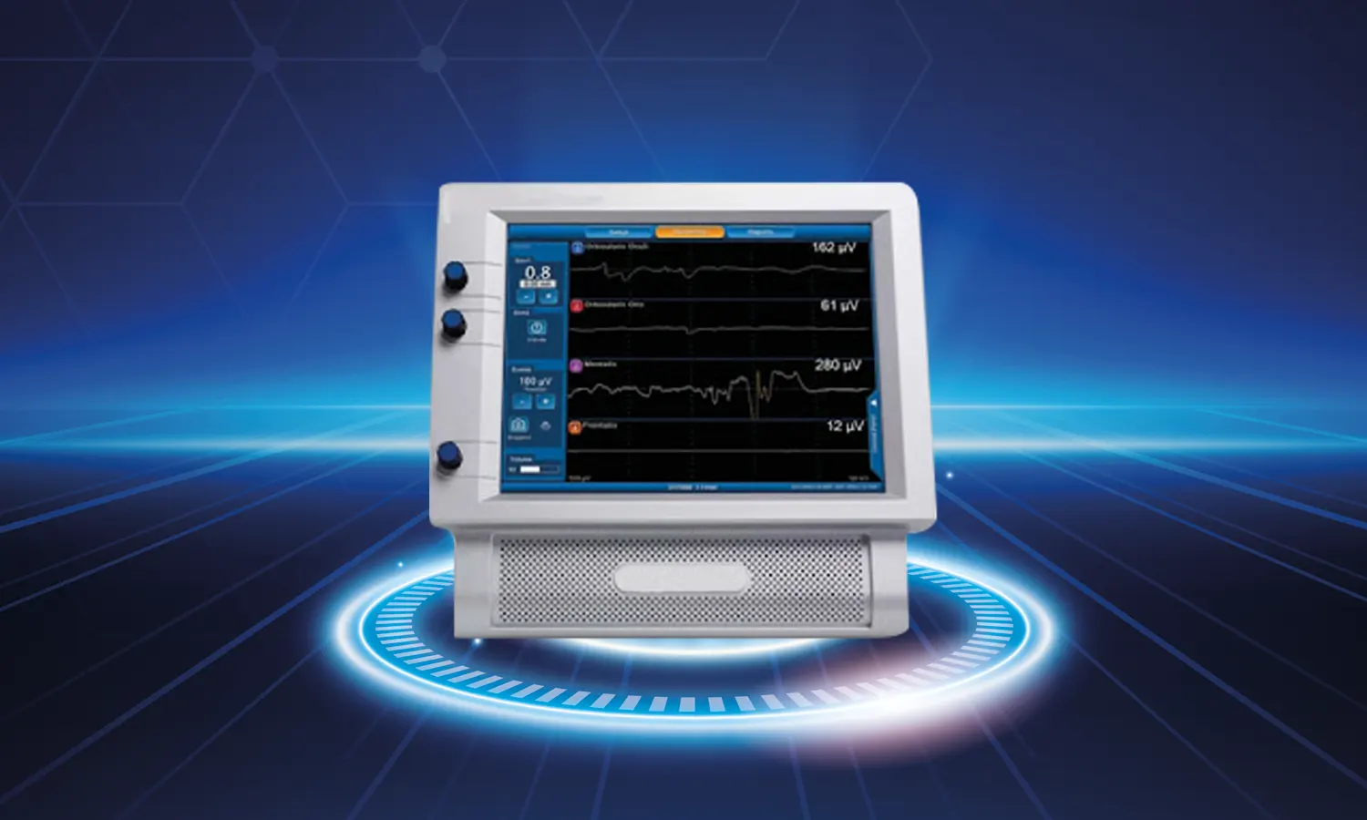 Nerve Monitoring in Thyroid Surgery