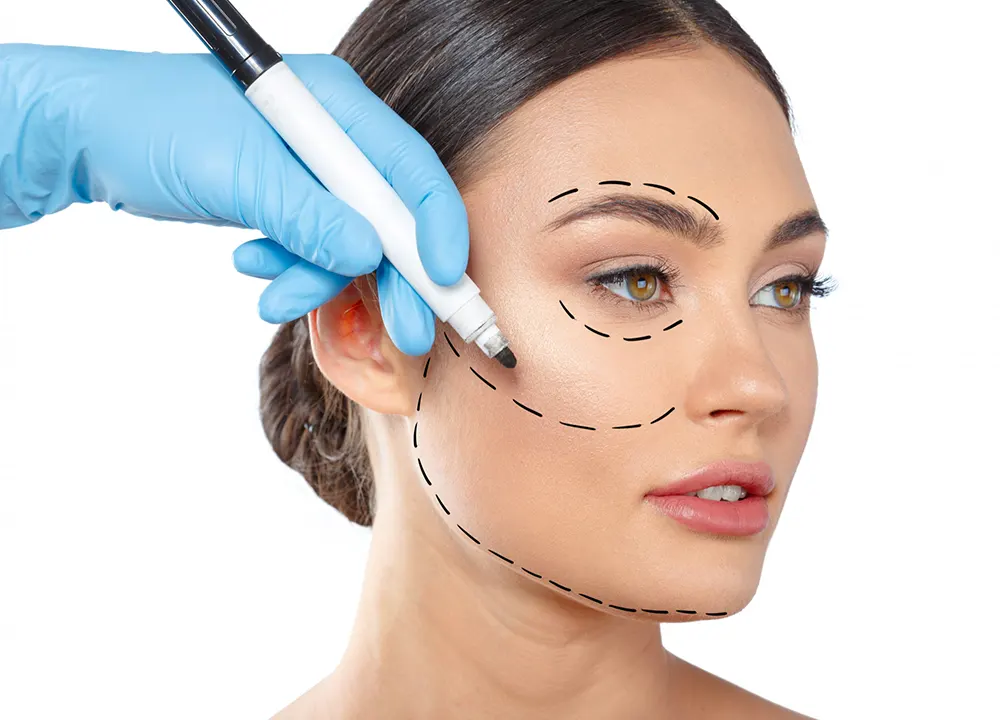 Facelift Surgery